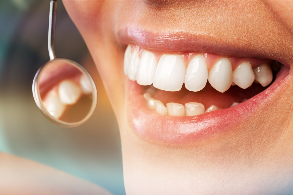 Odontology Periodontal Attractive Teenager Beautiful Girl Bleaching